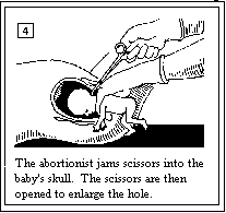 Partial Birth Abortion_4.gif (2393 bytes)